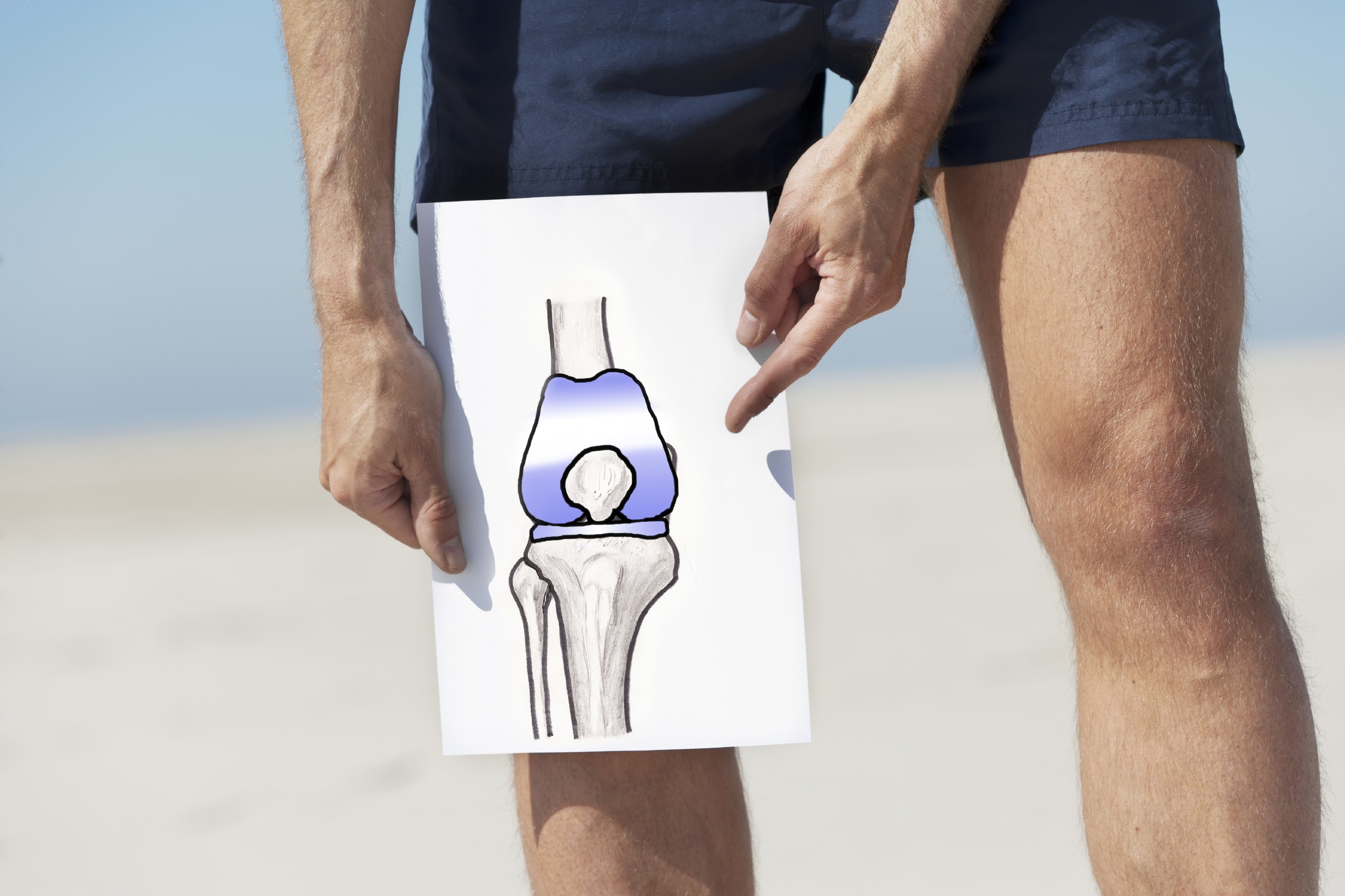 До белого коленя. Коленный сустав. Человек на коленях. Сустав колена. Артропластика коленного сустава.